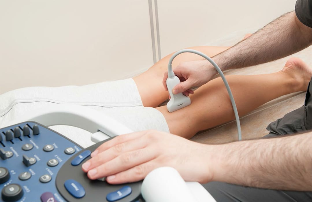 A Doctor Answers All Your Questions About Varicose Veins - Toronto  Dermatology Centre