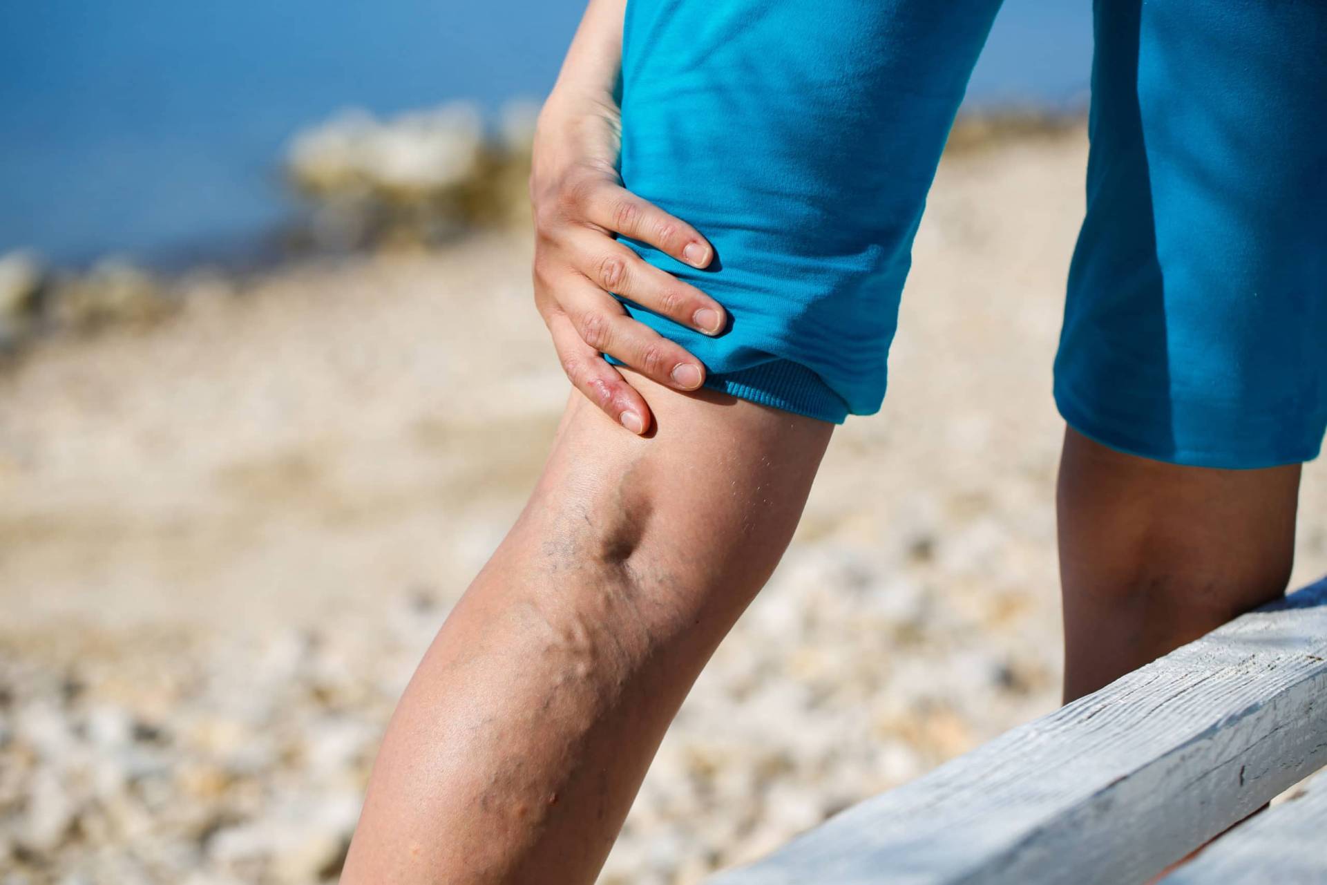 Legs Vein Treatment-The Vein Institute of Toronto